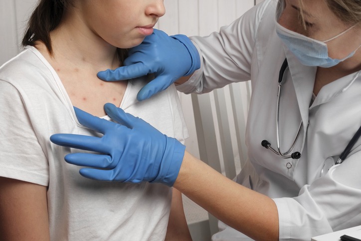 Doctor Checking Skin of Sick Girl for symptoms of measles
